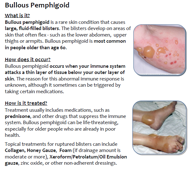 Bollous Pemphigoid