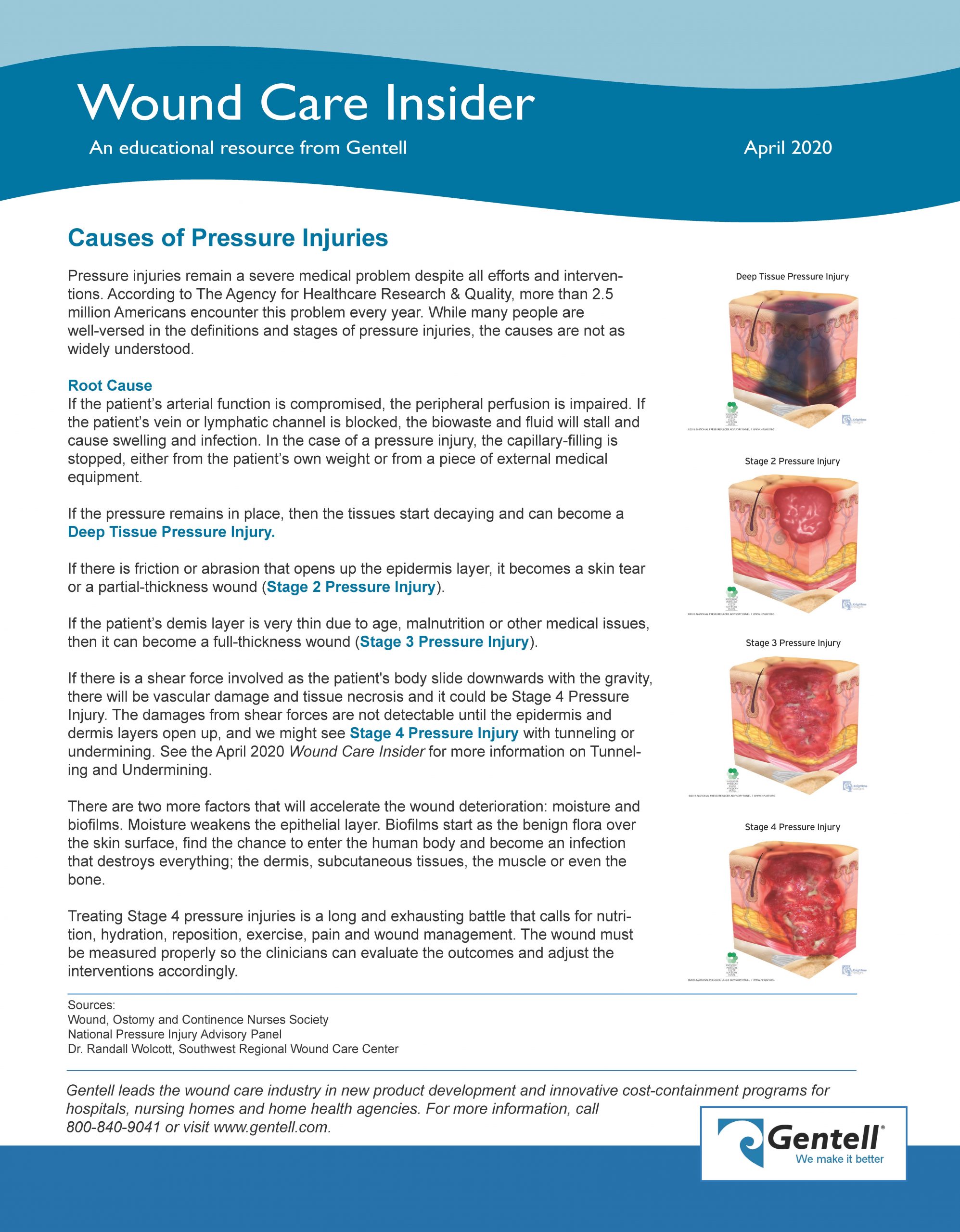 April 2020 Causes of PI - Gentell