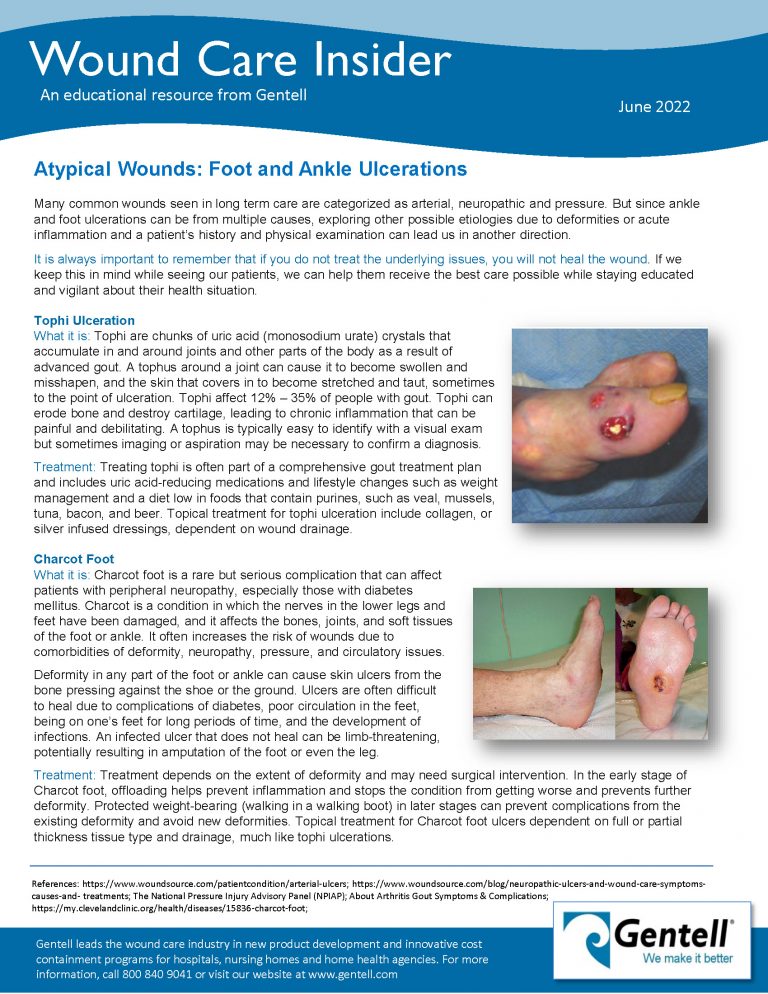 June 2022 Wound Care Insider Atypical Wounds - Gentell